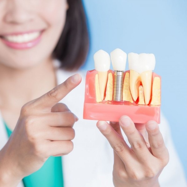 İmplant ve Diş